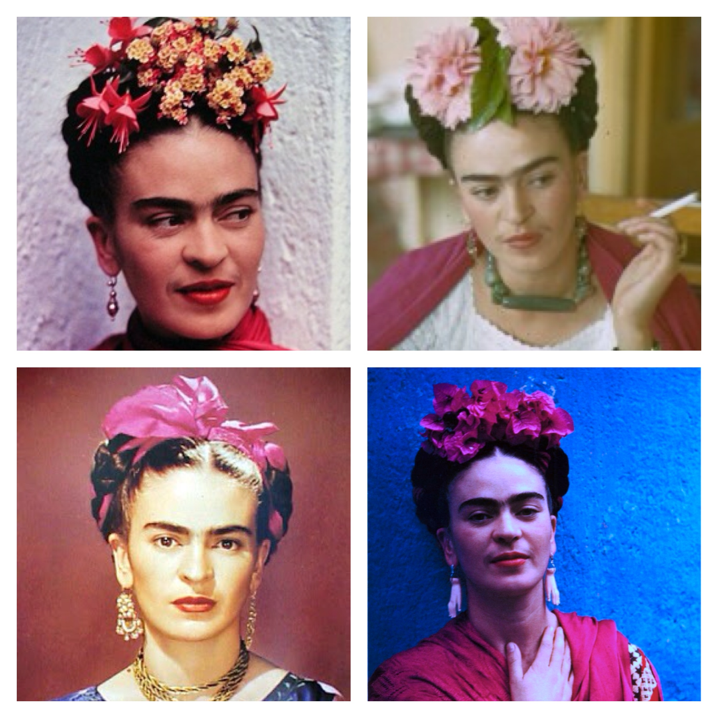 A Infância Marcada Pela Pólio e Suas Consequências - inspiração 2