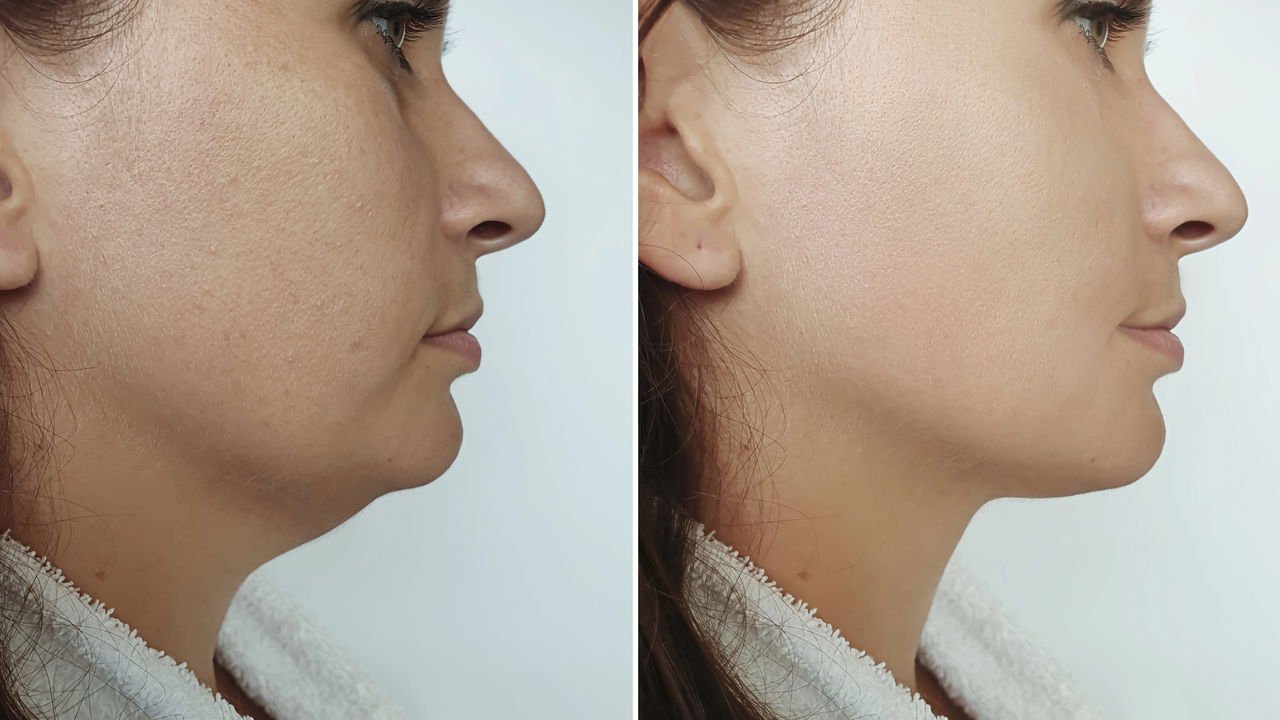 Entenda Por Que Seu Rosto Incha - inspiração 1