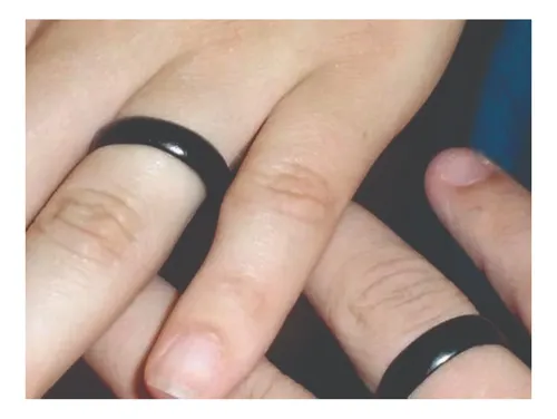 Anel de Tucum no Polegar: Entenda o Código Lésbico no Brasil