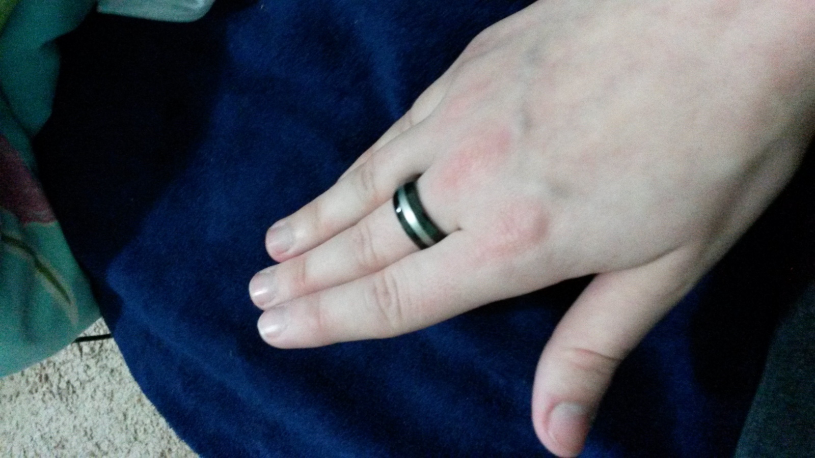 Anel de Tucum no Polegar: Entenda o Código Lésbico no Brasil