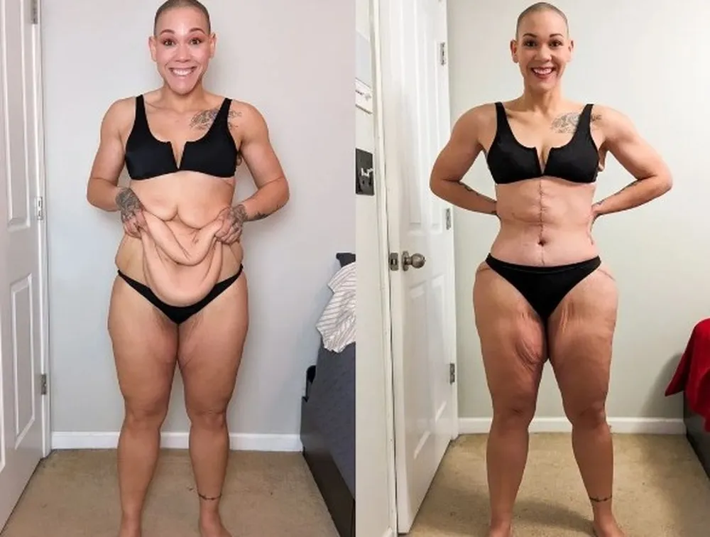 5 ideias de títulos