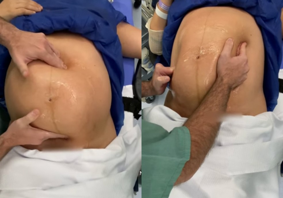 bebê pélvico tem algum problema