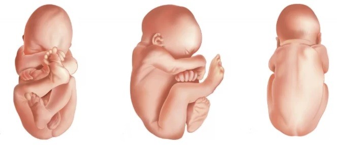 1. O Que Fazer Quando o Bebê Está Pélvico: Guia Completo
2. Displasia do Quadril: Entenda a Ligação com o Bebê Pélvico
3. Técnicas Seguras para Ajudar o Bebê a Virar na Gravidez
4. Parto Pélvico: Riscos e Alternativas para a Mamãe e o Bebê
5. Quando a Cesariana é a Melhor Opção para Bebê Pélvico?