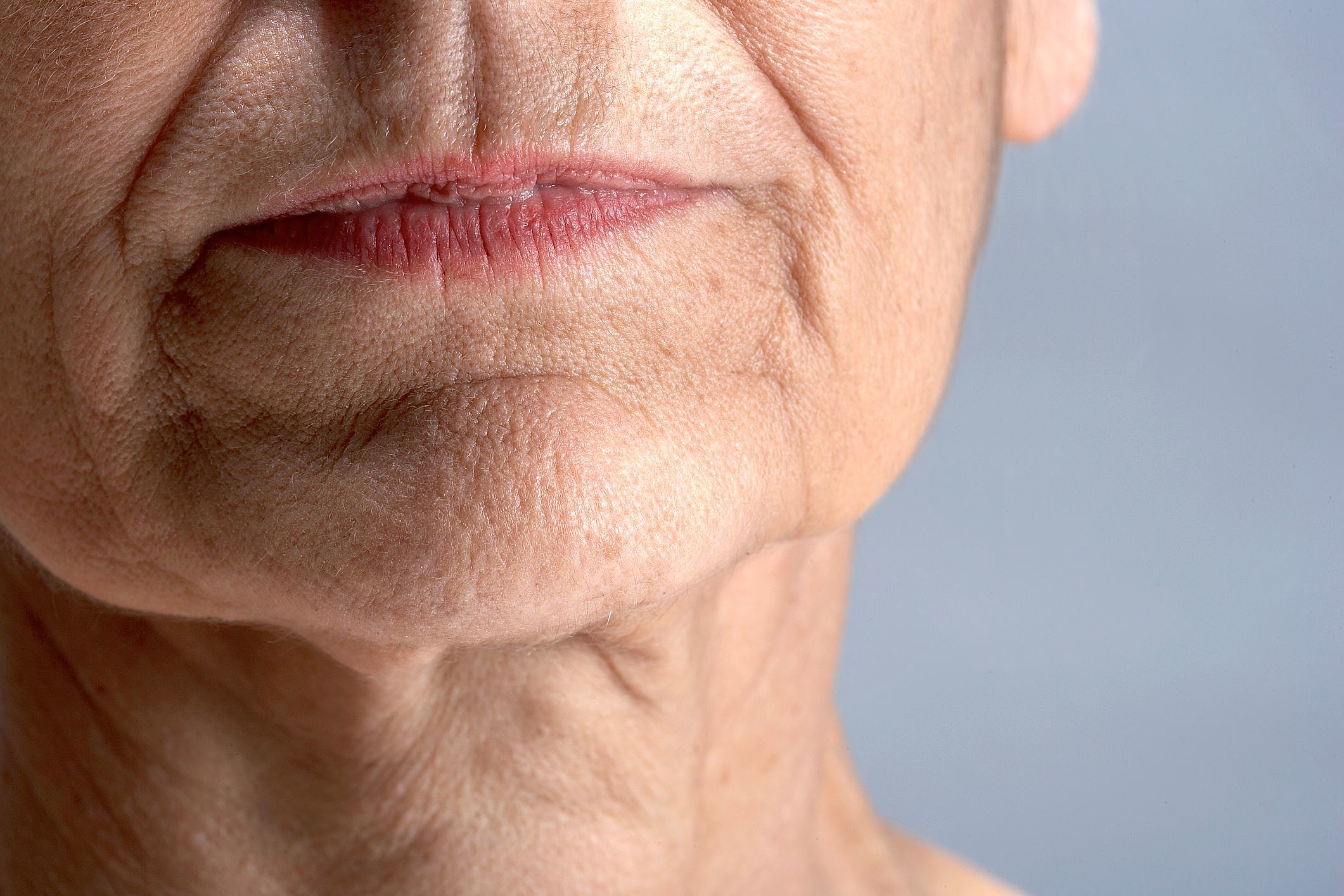 Ultraformer e Fotona: Tecnologias Avançadas para Suavizar o Bigode Chinês