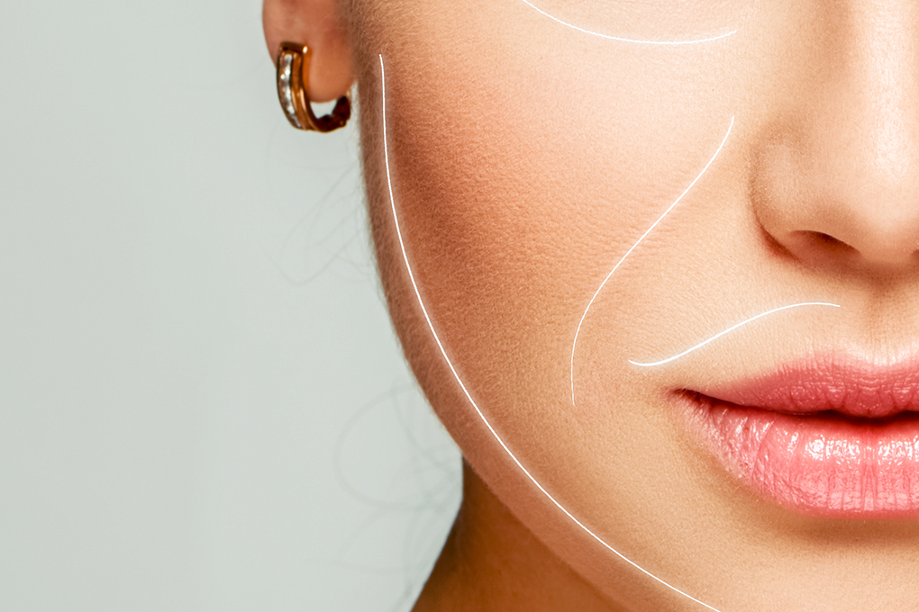 Prevenção do Bigode Chinês: Hábitos Essenciais e Dicas de Skincare