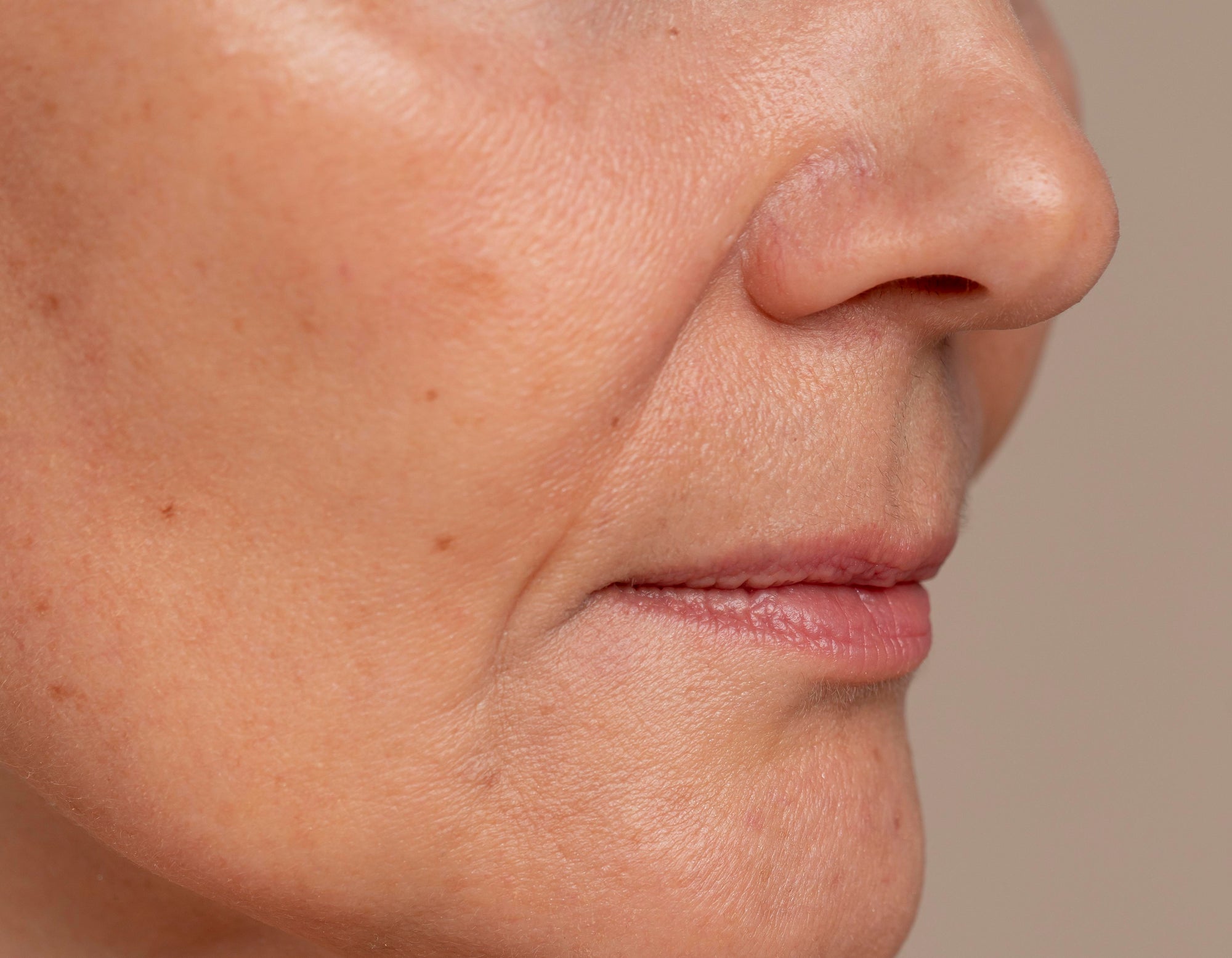 Ultraformer e Fotona: Tecnologias Avançadas para Suavizar o Bigode Chinês