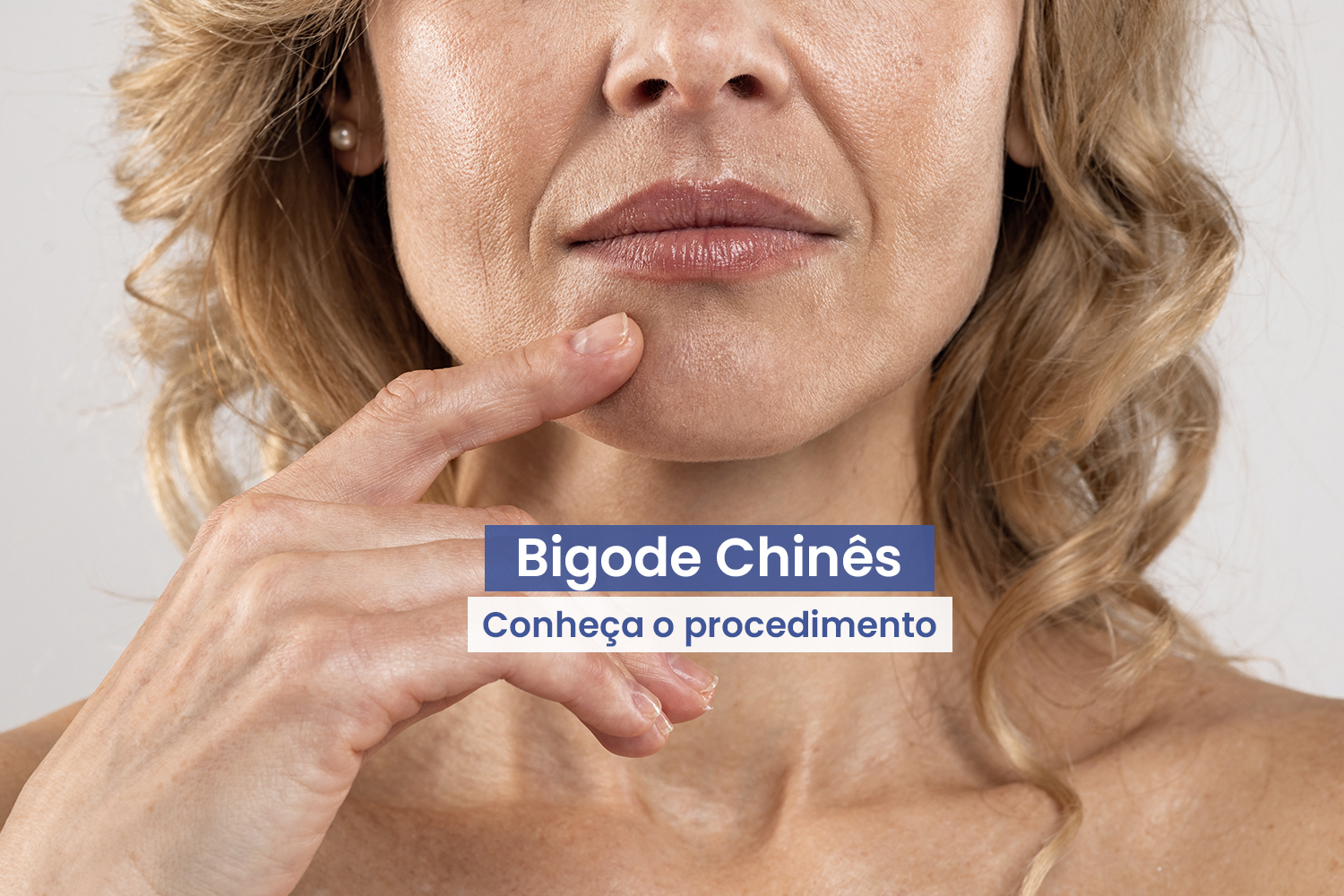 Bioestimuladores de Colágeno: A Solução para Flacidez e Bigode Chinês