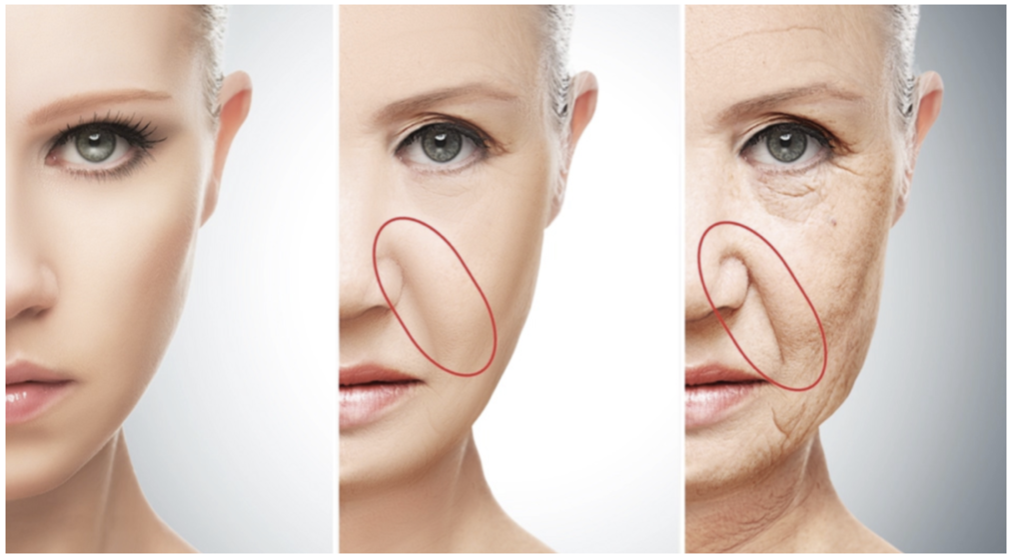 Prevenção do Bigode Chinês: Hábitos Essenciais e Dicas de Skincare