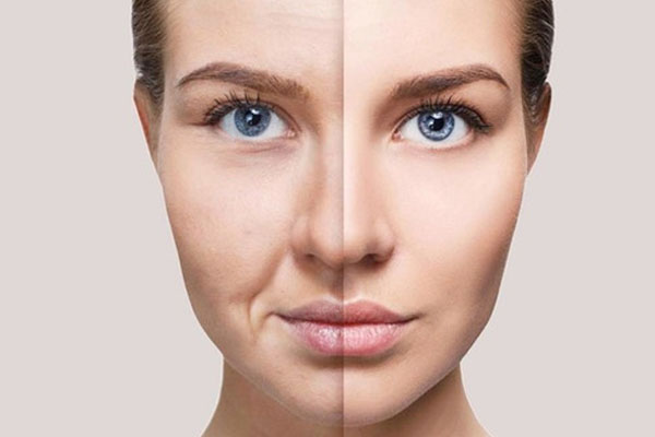 Ultraformer e Fotona: Tecnologias Avançadas para Suavizar o Bigode Chinês