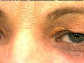 Xantelasma: Identificando e gerenciando depósitos de gordura