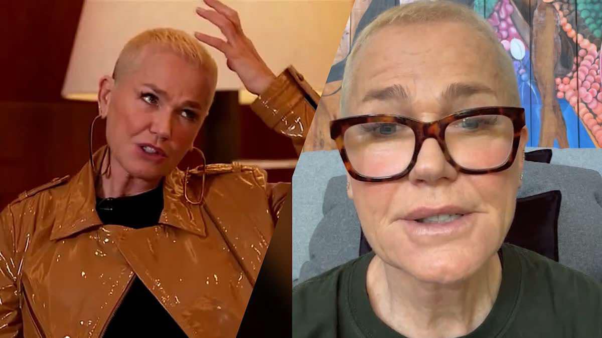Alopecia Androgenética: O que é e como Xuxa lida com a condição