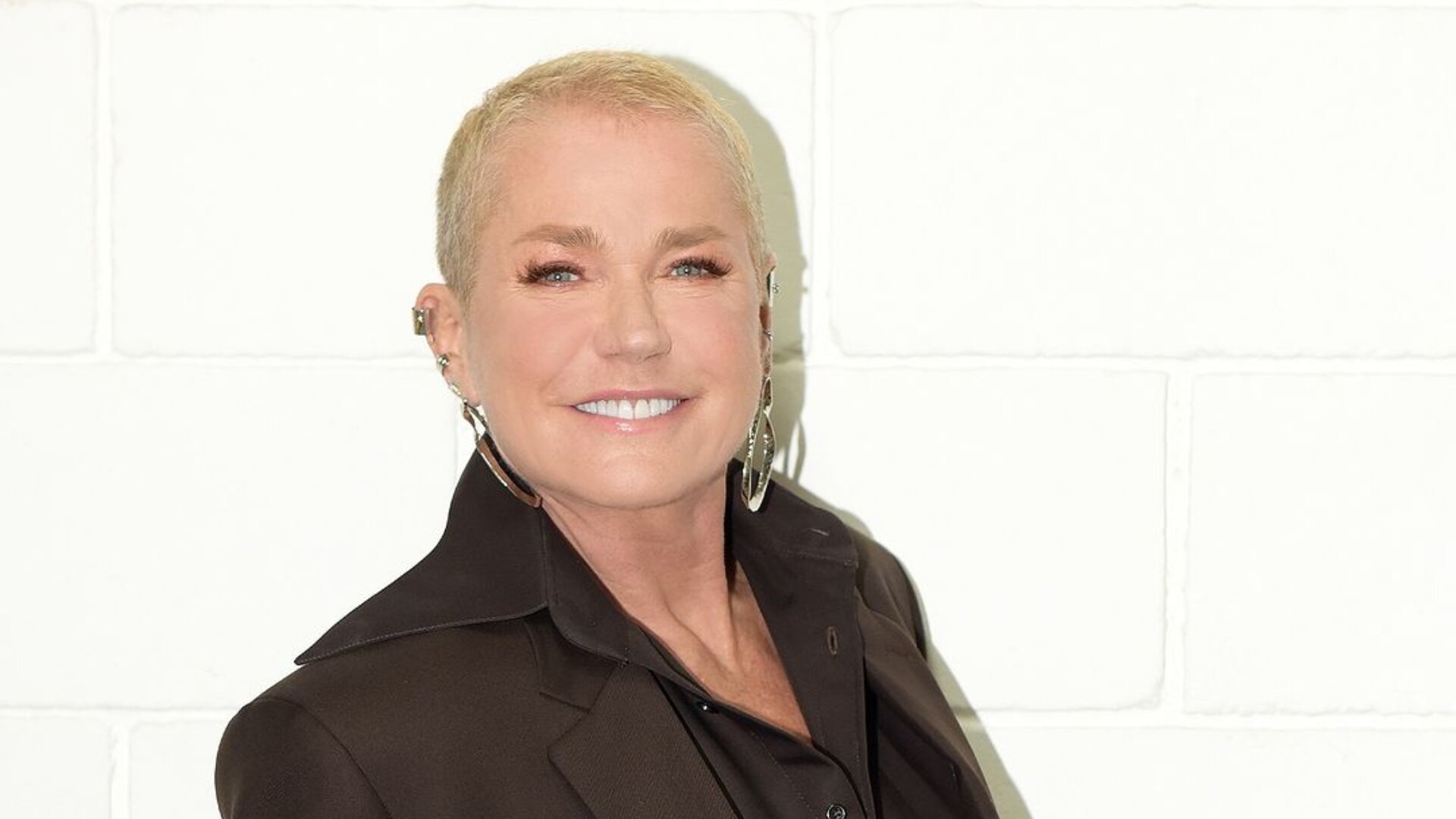 Transplante Capilar Feminino: Guia completo sobre o procedimento e resultados