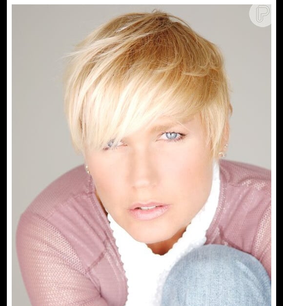 Xuxa e a Calvície Feminina: Um incentivo para buscar diagnóstico e tratamento