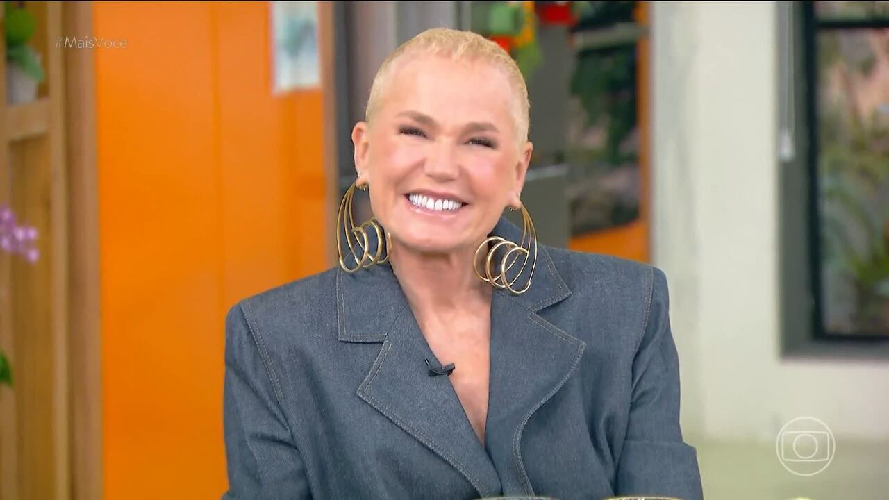 Alopecia Androgenética: O que é e como Xuxa lida com a condição