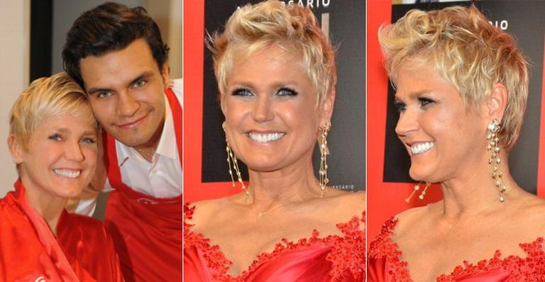 Xuxa e a Calvície Feminina: Um incentivo para buscar diagnóstico e tratamento
