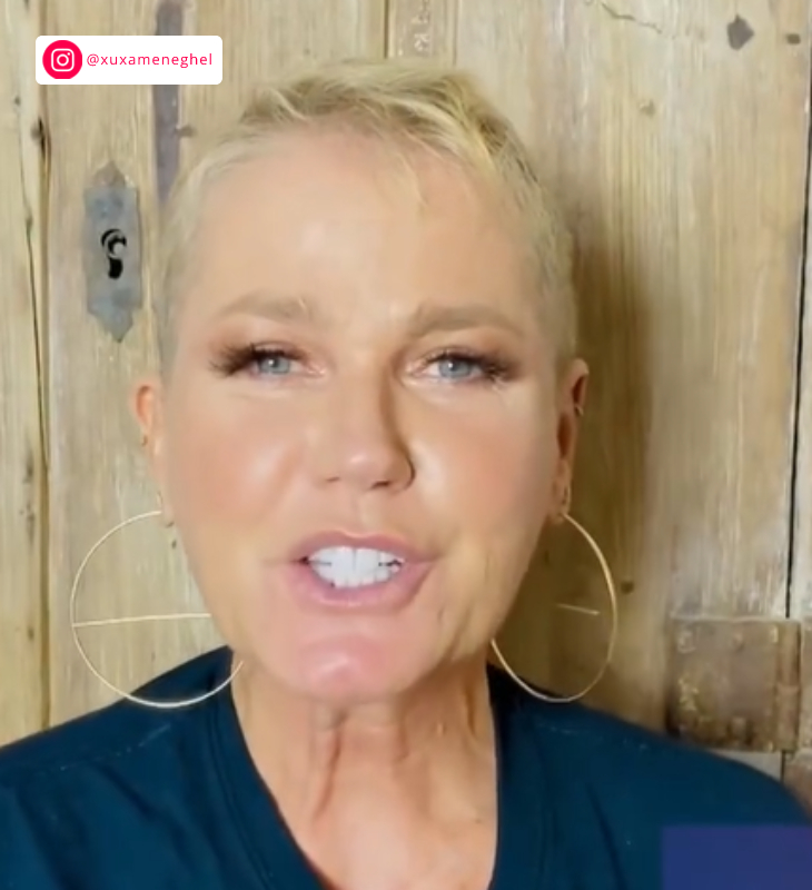 Antes e Depois: Fotos do transplante capilar de Xuxa e a recuperação do volume