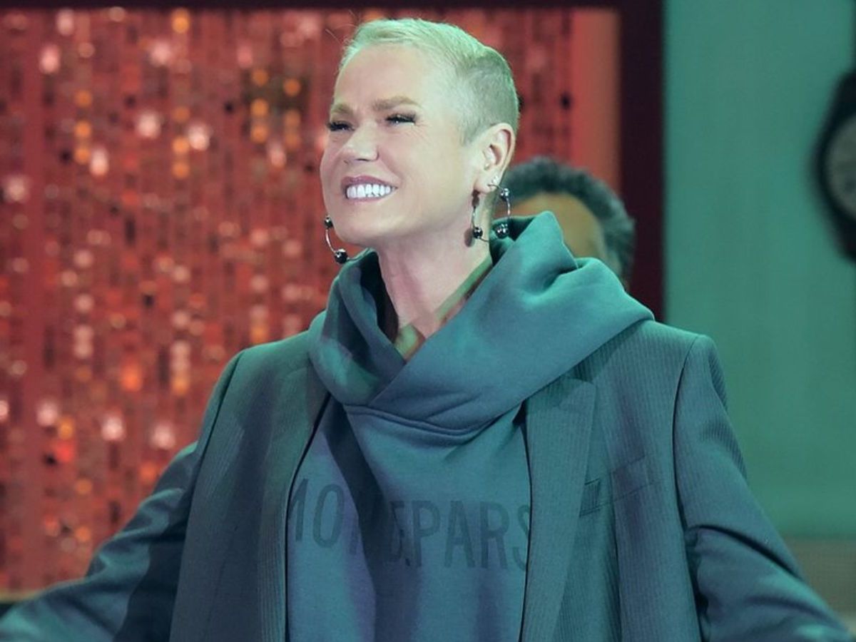 Transplante Capilar Feminino: Guia completo sobre o procedimento e resultados