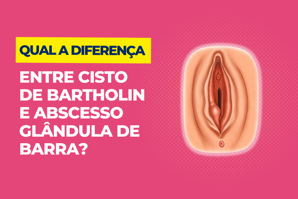 caroço na vagina