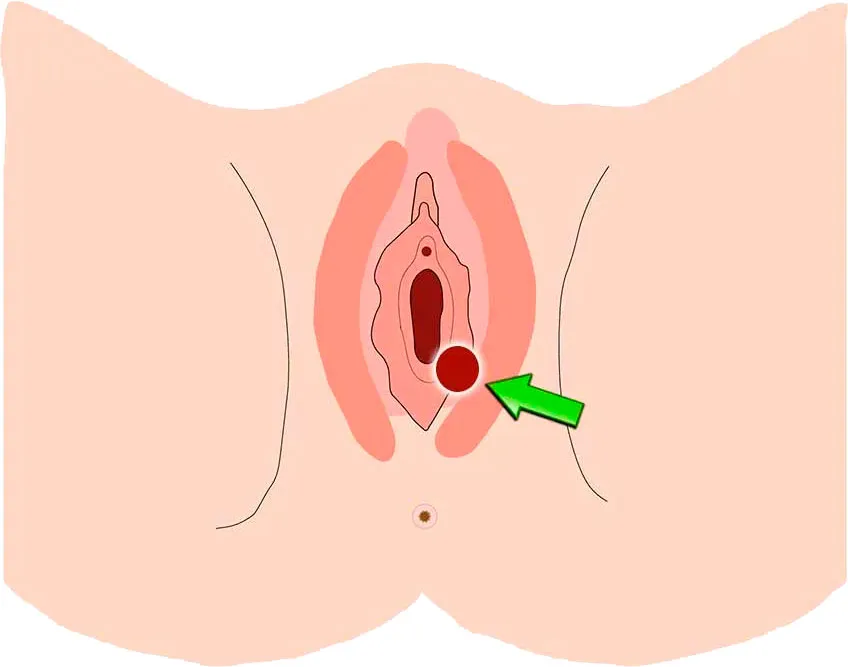 bolinha na vulva
