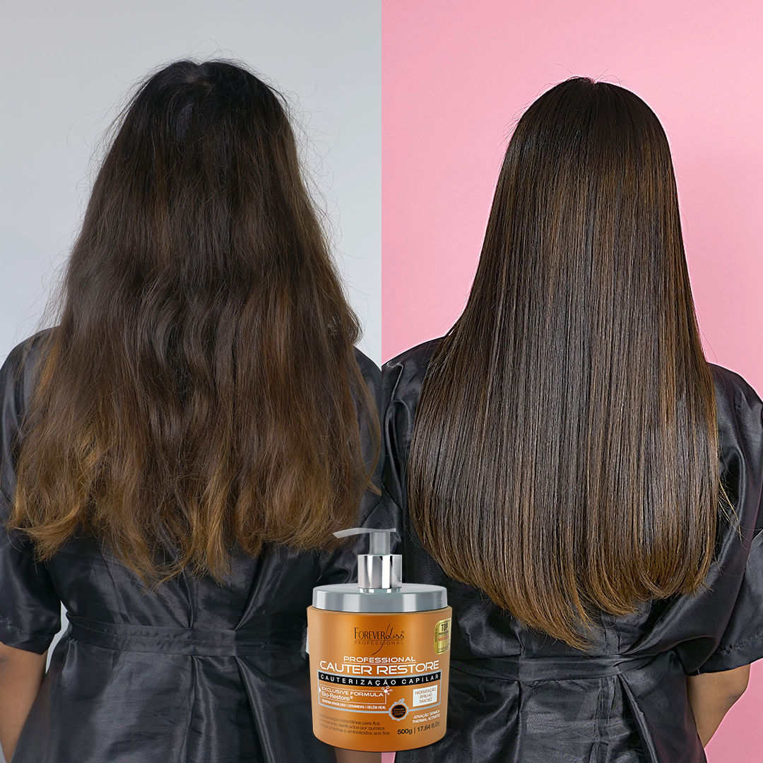 cauterização capilar