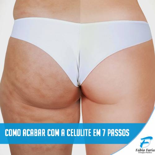 celulite como diminuir