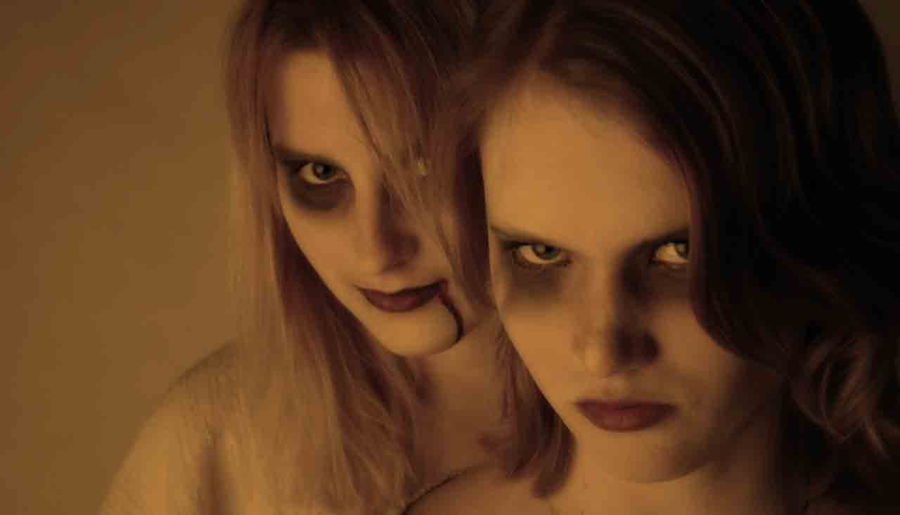 5 Dicas Caseiras para Remover Chupão Rapidamente