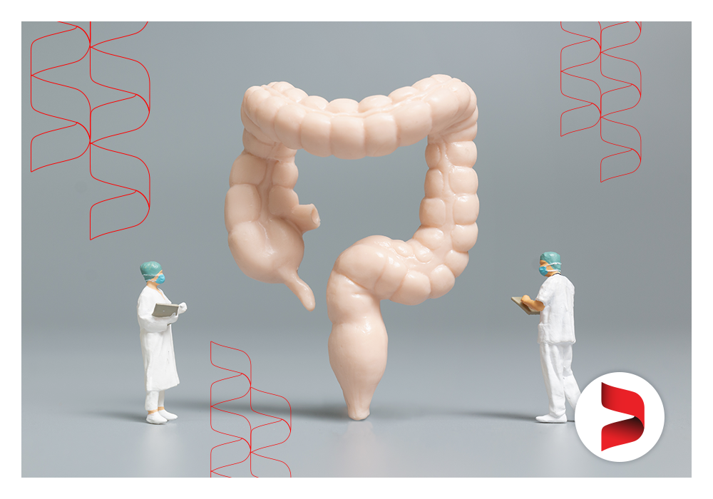 Doenças Inflamatórias Intestinais: Quando a Colectomia se Torna Necessária?