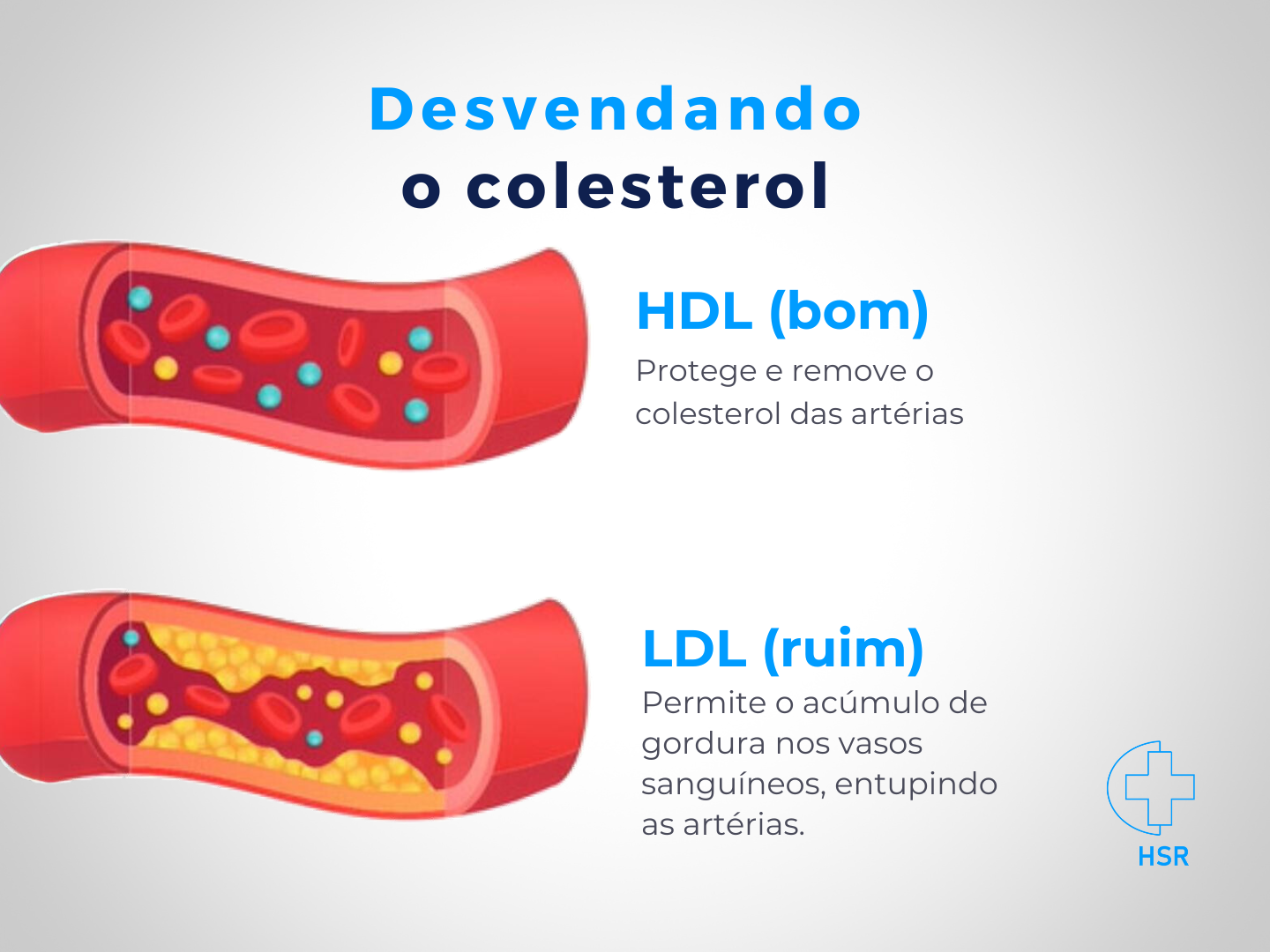 Mitos e Verdades sobre o Colesterol: O que Você Realmente Precisa Saber
