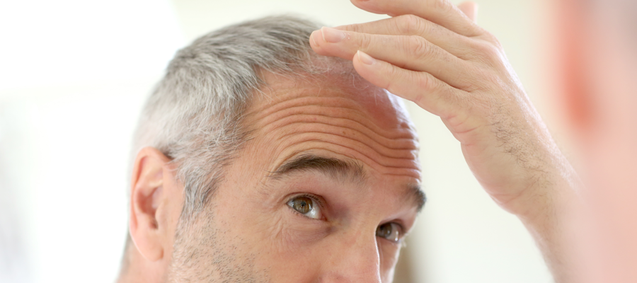 MMP e Microagulhamento: Procedimentos inovadores contra a calvície