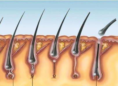 Melhores Esfoliantes Caseiros para Prevenir Pelos Encravados