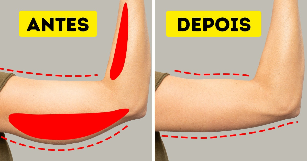 como afinar os braços