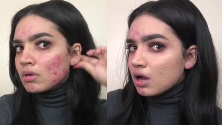 Melhores corretivos para espinhas