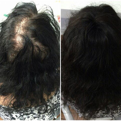 como disfarçar falhas no cabelo feminino