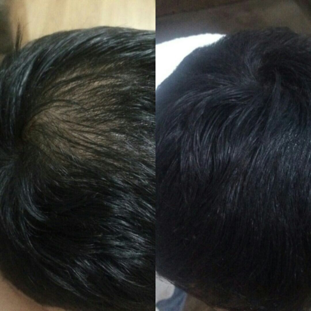 Fibras de Queratina: O que são e como usar para dar volume