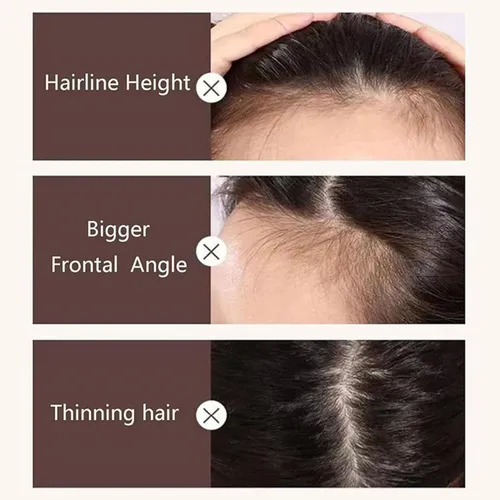 Tratamentos e Como Lidar no Dia a Dia