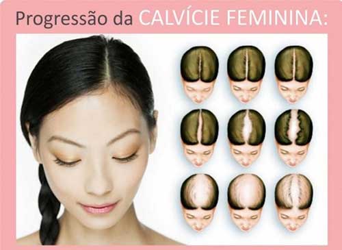 Fibras de Queratina: O que são e como usar para dar volume