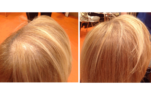 Tratamentos e Como Lidar no Dia a Dia