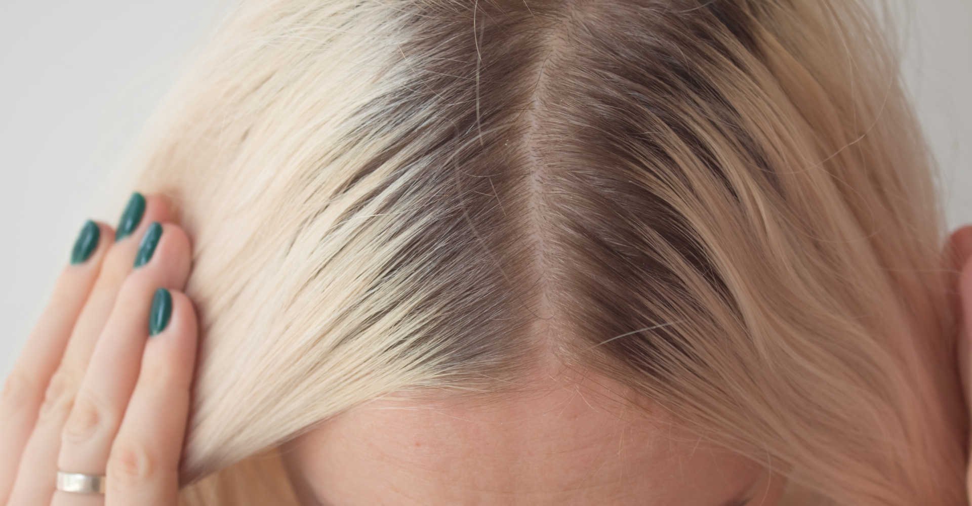 Acessórios Essenciais para Camuflar a Raiz Crescendo