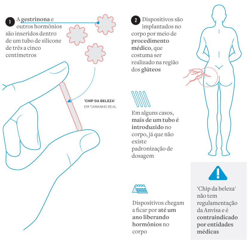 Como funciona o chip da beleza vs chip contraceptivo
