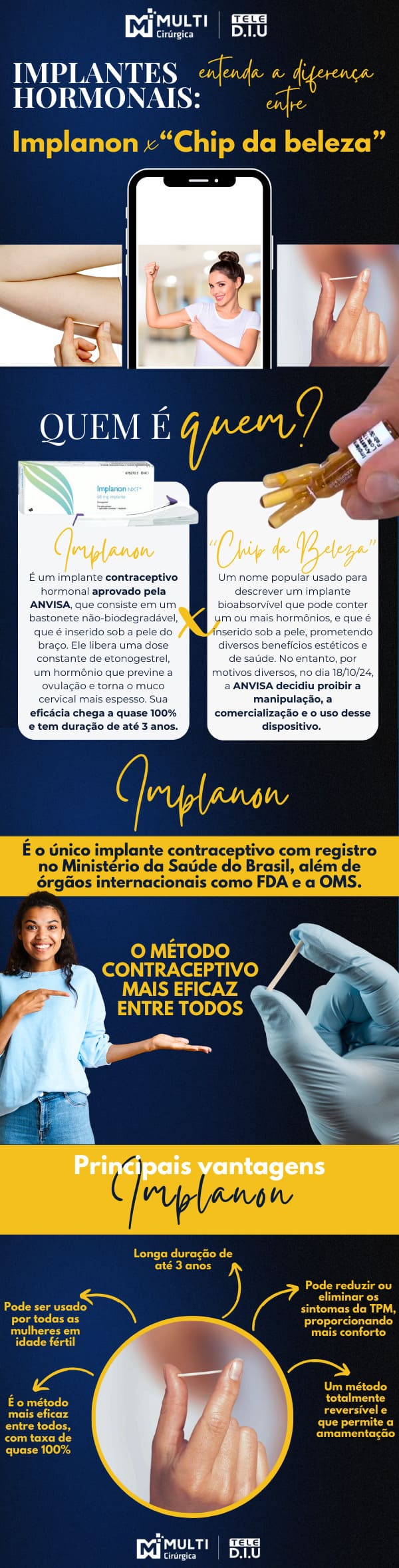 diferença chip da beleza e implanon