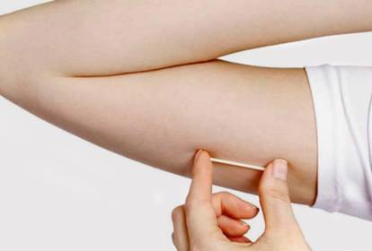 chip contraceptivo vs chip da beleza