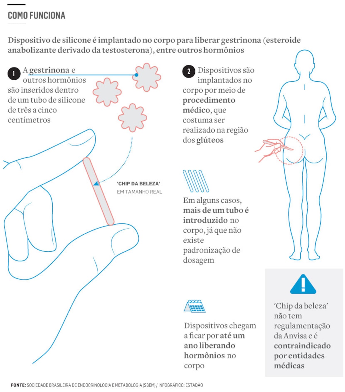 implante hormonal gestrinona