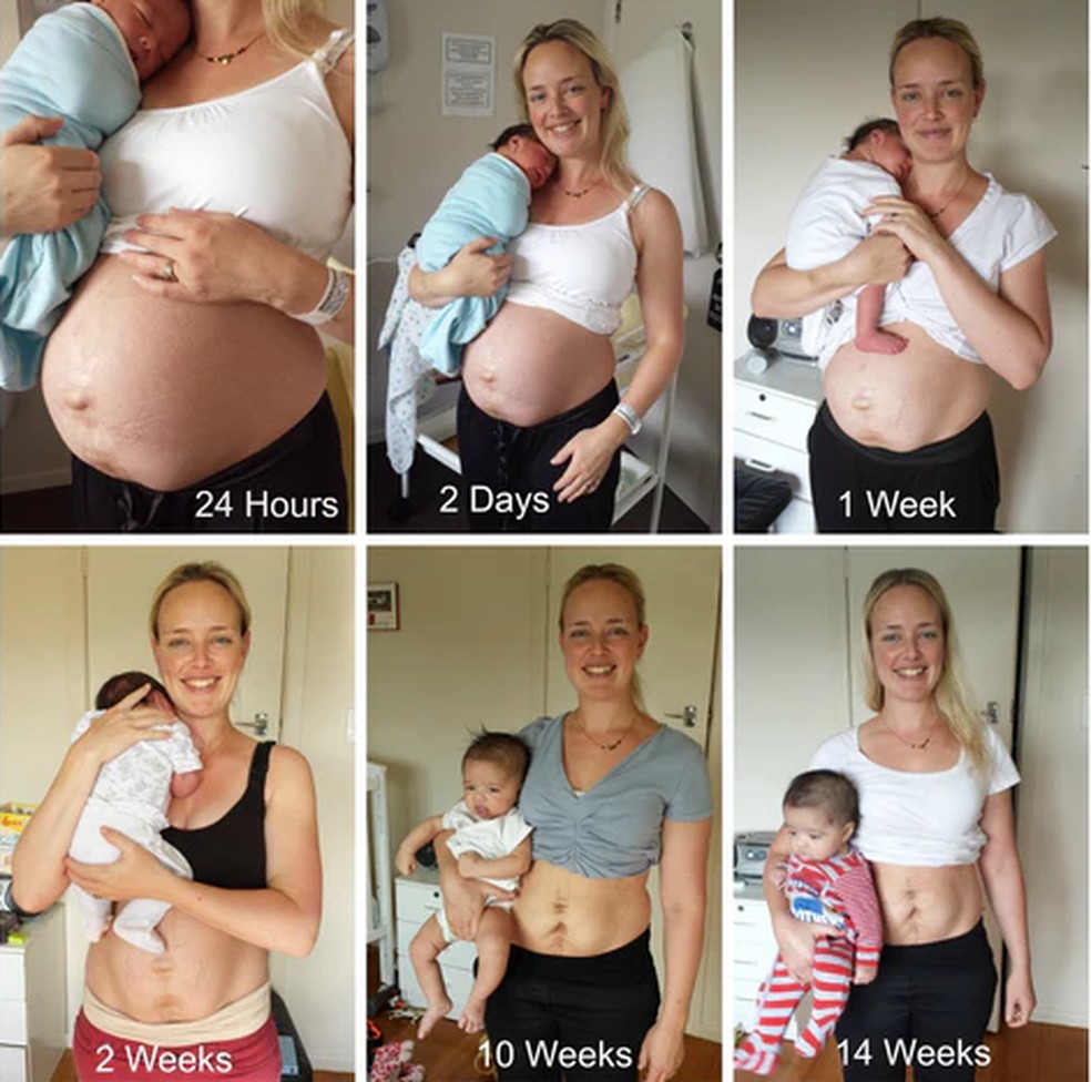 como perder a barriga depois da gravidez