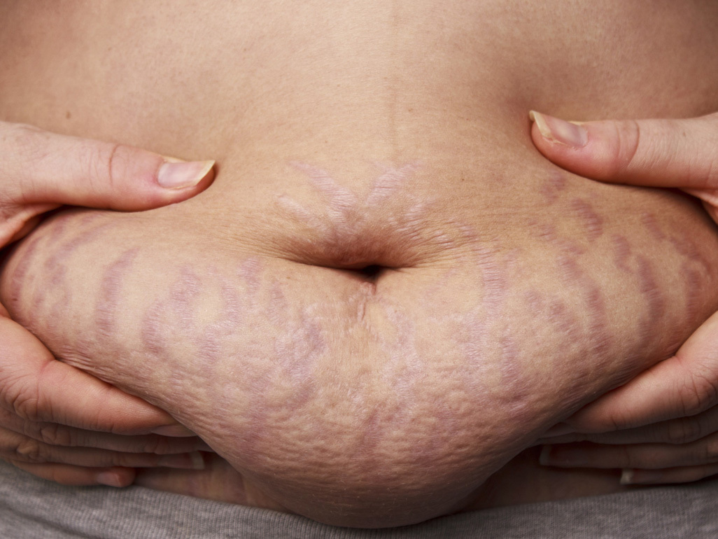 Dieta Pós-Parto: O Que Comer para Emagrecer Amamentando sem Prejudicar o Bebê