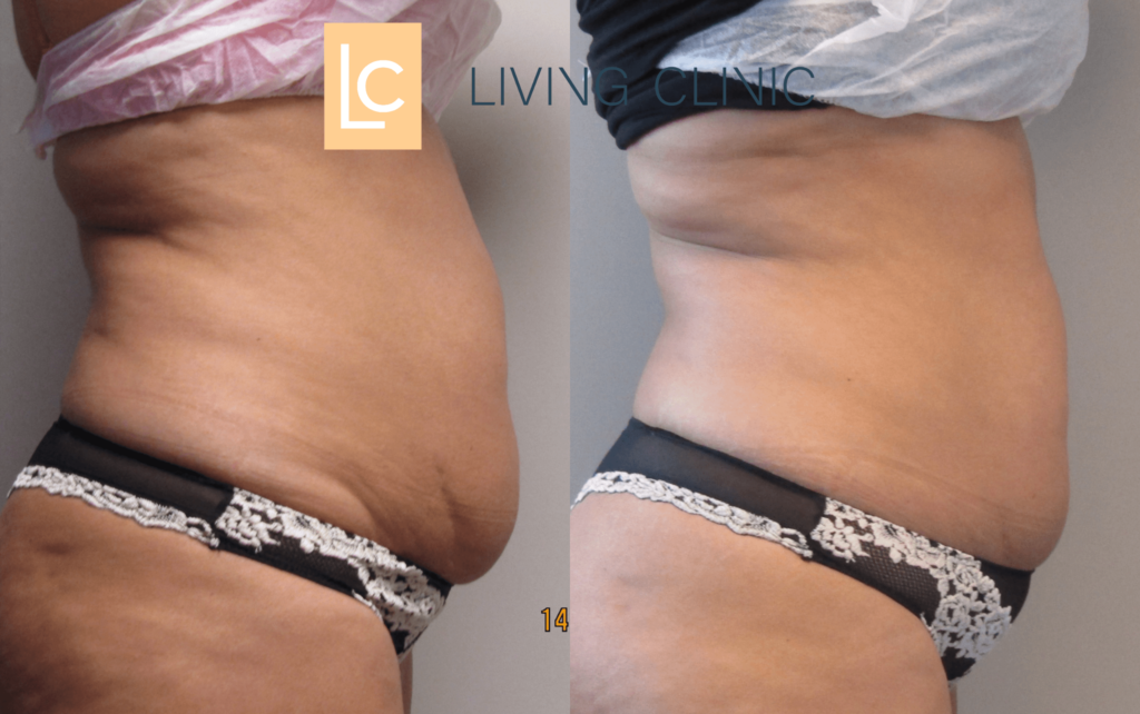 Guia Completo de Exercícios Seguros para o Pós-Parto (Normal e Cesárea)