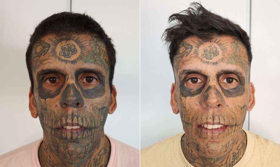 remover tatuagem com limão