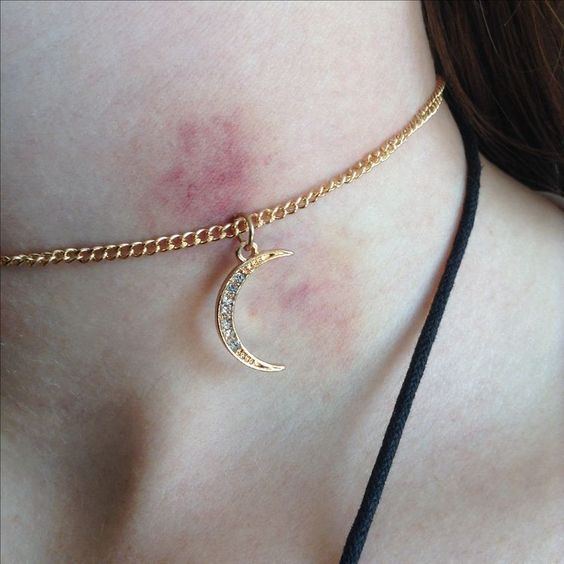 Como Usar Maquiagem para Cobrir Marcas Indesejadas