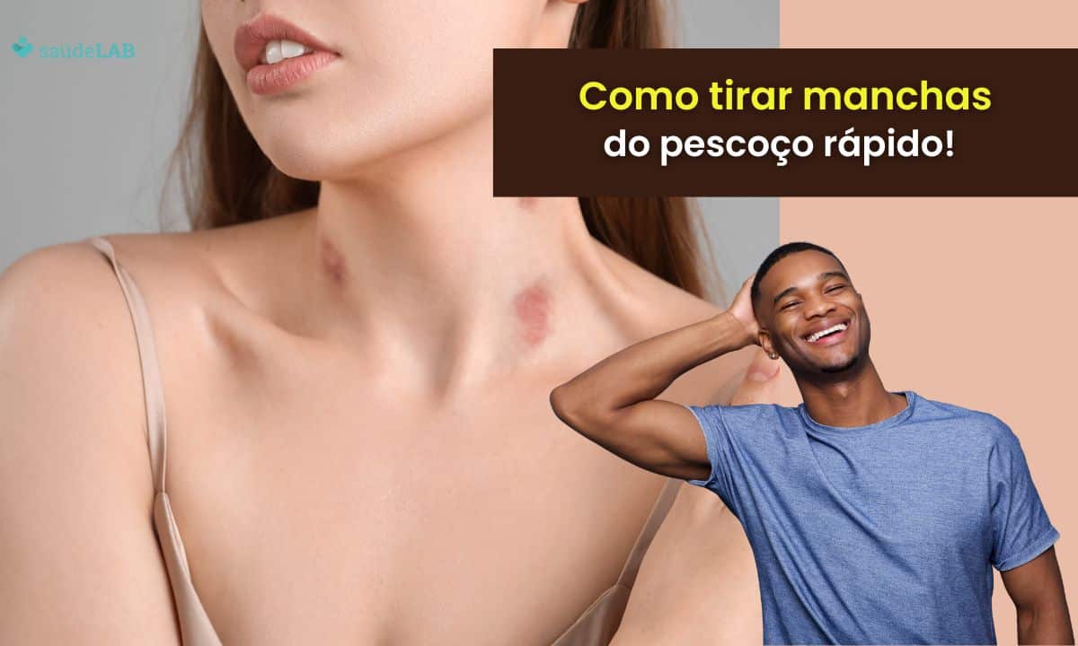 Dicas de Acessórios para Disfarçar Marcas no Pescoço