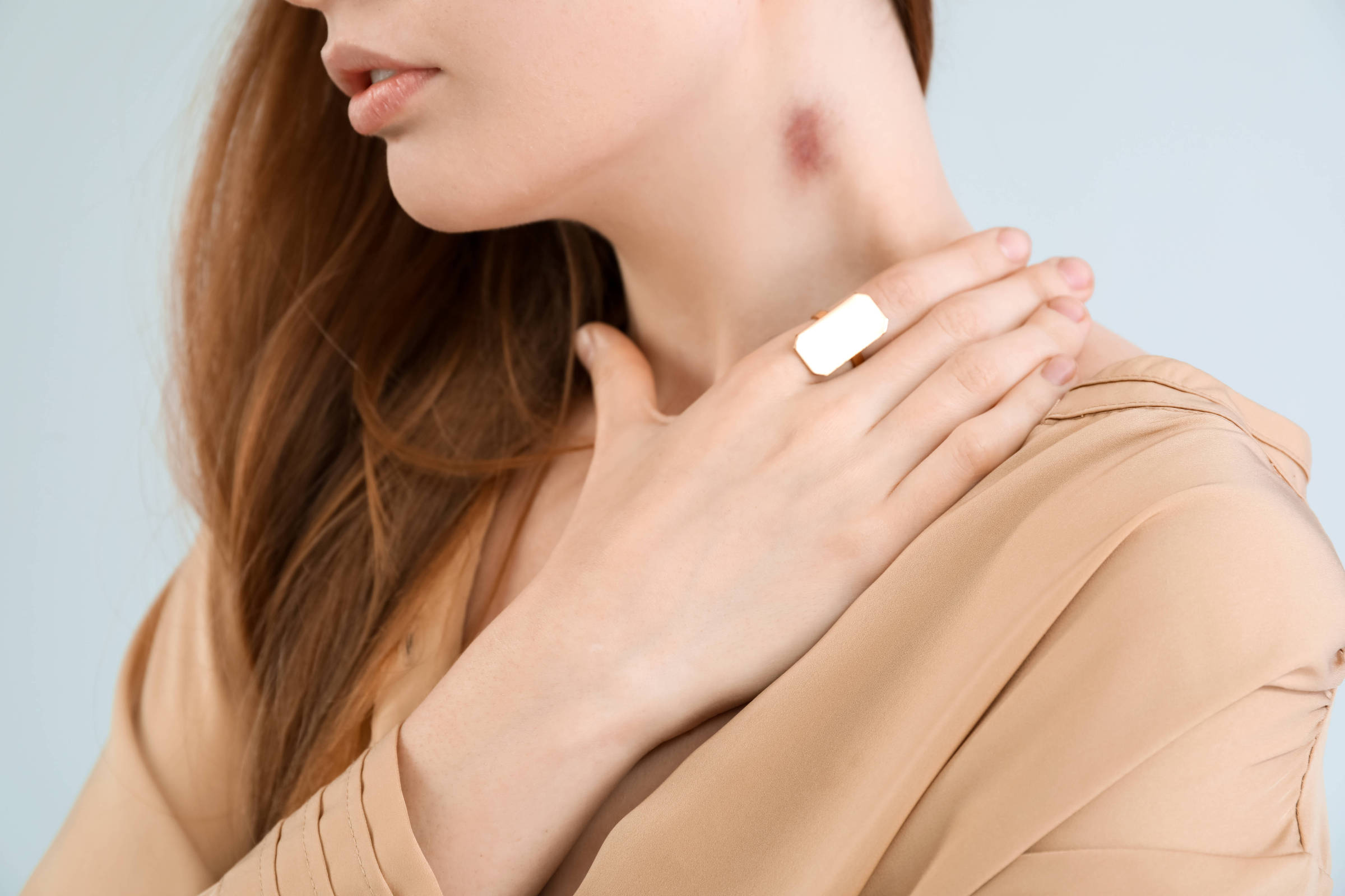 Os Melhores Cremes e Pomadas para Remover Hematomas