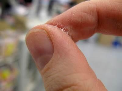 como tirar cola super bonder da mao